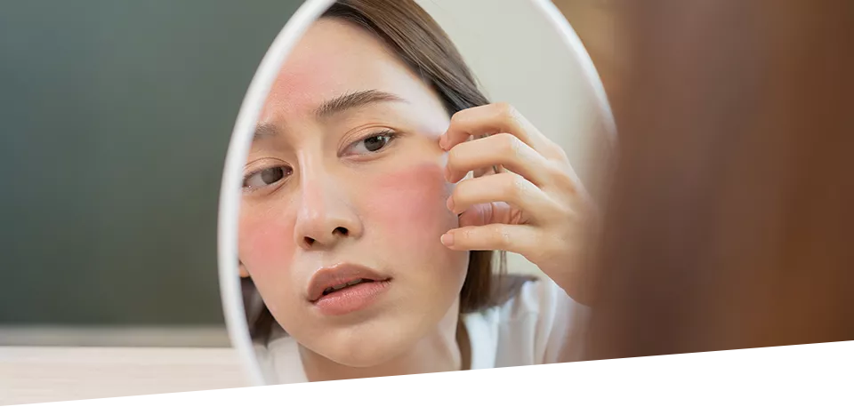 7 Skincare Tips To Rescue Sensitive Skin