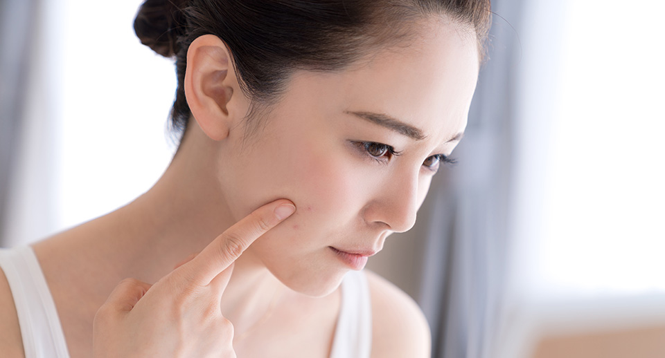 4 Common Skincare Problems and How To Counter Them - Image 1