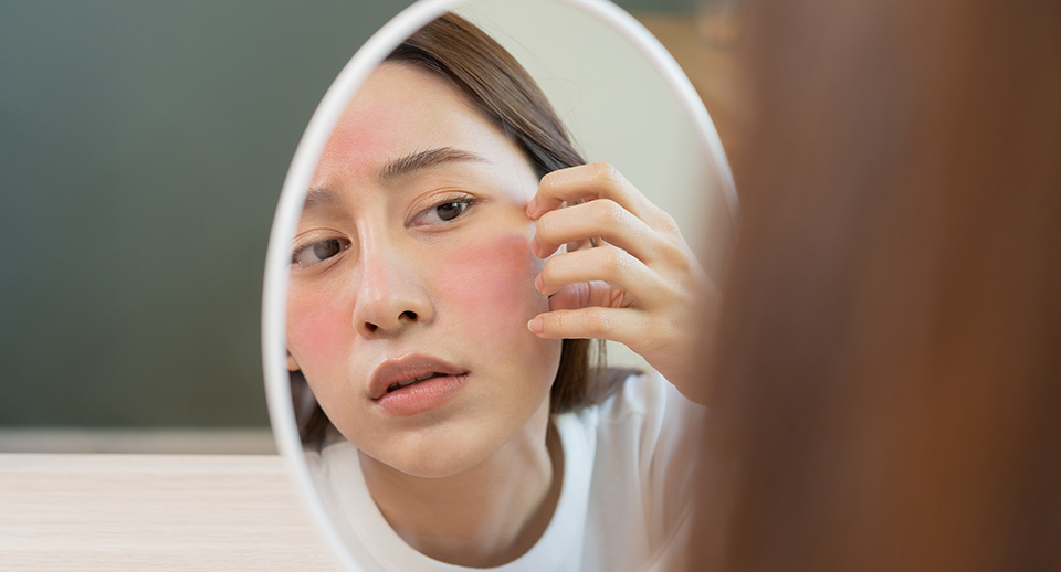 7 Skincare Tips To Rescue Sensitive Skin - Image